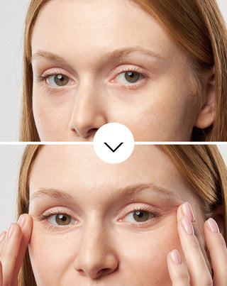 Kosteuttava silmänympärysvoide ryppyille ja tummille silmänalusille Nutridome-helmiuutteella. - 3