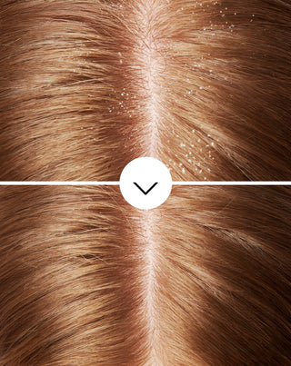 Hilsettä ehkäisevä hiusshampoo, jossa on olamiinipyroktonia, jolla on kosteuttava vaikutus Nutridome - 5