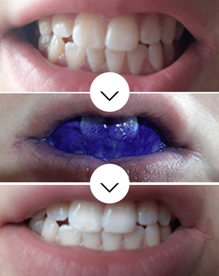 White Bite Smilebite hampaiden väriä korjaava seerumi 30 ml - 3