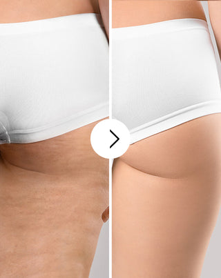 Selluliittia ja ihonparannus tabletit luonnollisilla uutteilla Cellinea 60 kapselia_3 - 3