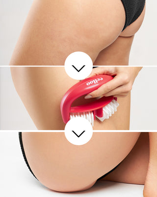 Anti-selluliittimassaaattori välilehdillä taistelee selluliittia vastaan ja vähentää lihasjännitystä Crush my Celloon - 3