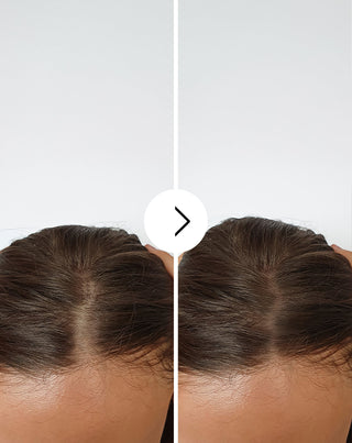 Hiustenlähtökapselit, joilla on paksuuntuva ja vahvistava vaikutus Follixin 60 kapselia_4 - 4