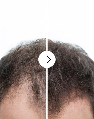 Hiustenlähtökapselit, joilla on paksuuntuva ja vahvistava vaikutus Follixin 60 kapselia_2 - 2