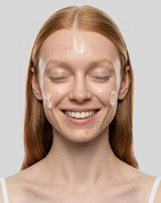 Anti-akne päivävoide salisyyli- ja atsaleenihapolla epäpuhtauksia vastaan Anti-Acne Orphica Clinic 50 ml